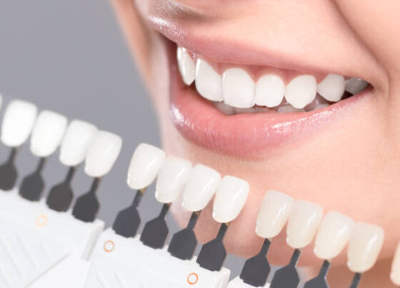 Teeth Whitening in Riyadh